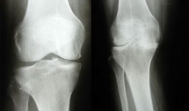 Kelio diagnozės metodai