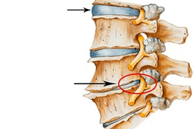 Normali ir pažeista stuburo su gimdos kaklelio osteochondrozė