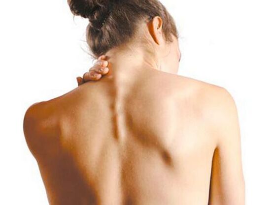 Mergina serga gimdos kaklelio osteochondroze
