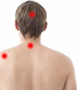 Skausmo vieta sergant gimdos kaklelio osteochondroze
