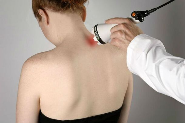 fizioterapinės priemonės gimdos kaklelio osteochondrozei gydyti
