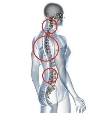stuburo osteochondrozės vietos